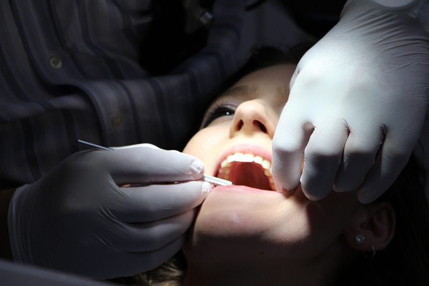 Zahnversiegelung / Fissurenversiegelung