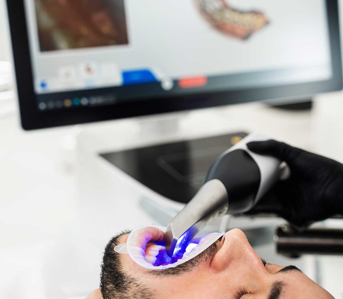 Professionelle Zahnreinigung in Ostfildern-Kemnat 